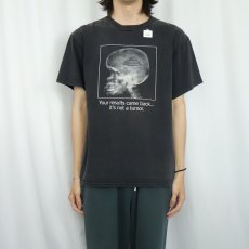 画像2: "Your results came back... it's not a tumor." レントゲン ジョークプリントTシャツ BLACK L (2)