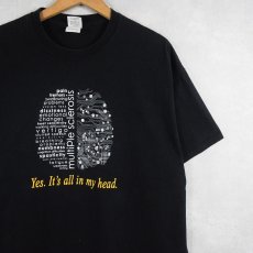 画像1: multiple sclerosis "Yes. It's all in my head" プリントTシャツ BLACK XL (1)