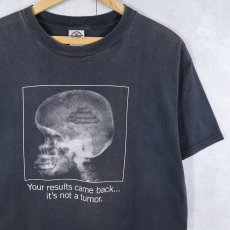 画像1: "Your results came back... it's not a tumor." レントゲン ジョークプリントTシャツ BLACK L (1)