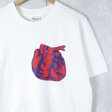画像1: 90's ABBOKINASE USA製 メディカル企業プリントTシャツ L (1)